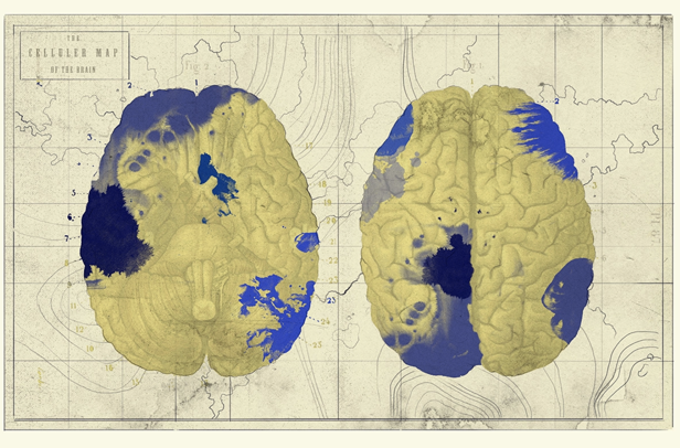 Brain Circuits / The Transmitter