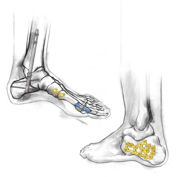 Ortho Soultions