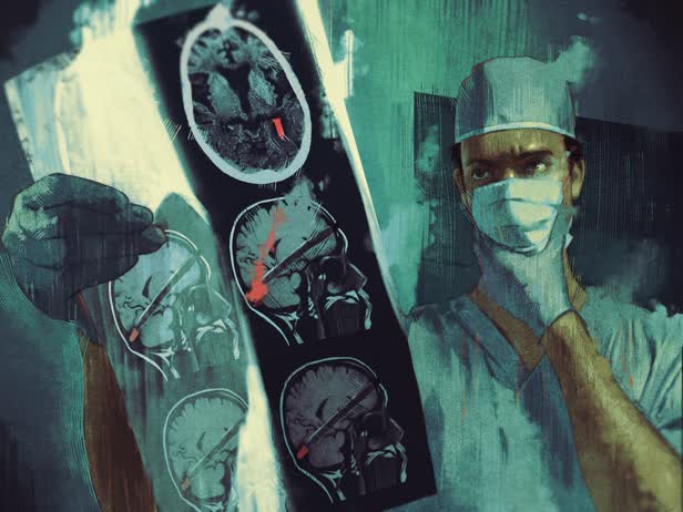 Bullet Brain Surgery